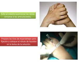 Prepare las tiras de esparadrapo para
fijación y coloque el rótulo de líquidos
en la bolsa de la solución.
Evite al máximo puncionar las venas
cercanas a las articulaciones.
 