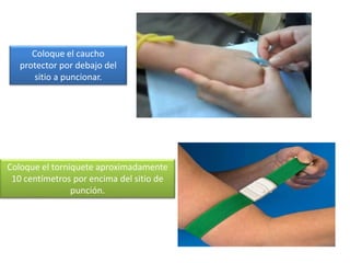 Coloque el torniquete aproximadamente
10 centímetros por encima del sitio de
punción.
Coloque el caucho
protector por debajo del
sitio a puncionar.
 