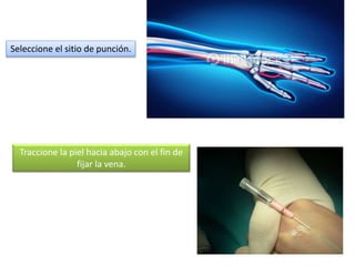 Traccione la piel hacia abajo con el fin de
fijar la vena.
Seleccione el sitio de punción.
 