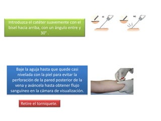 Baje la aguja hasta que quede casi
nivelada con la piel para evitar la
perforación de la pared posterior de la
vena y aváncela hasta obtener flujo
sanguíneo en la cámara de visualización.
Retire el torniquete.
Introduzca el catéter suavemente con el
bisel hacia arriba, con un ángulo entre y
30° .
 