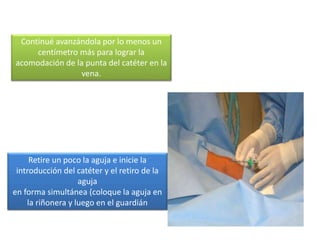 Continué avanzándola por lo menos un
centímetro más para lograr la
acomodación de la punta del catéter en la
vena.
Retire un poco la aguja e inicie la
introducción del catéter y el retiro de la
aguja
en forma simultánea (coloque la aguja en
la riñonera y luego en el guardián
 
