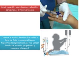 Realice presión sobre la punta del catéter
para detener el retorno venoso.
Conecte el equipo de venoclísis y abra la
llave de flujo, o coloque el tapón
heparinizado según el caso.(Si va a utilizar
bomba de infusión, prográmela y
colóquele el seguro).
 
