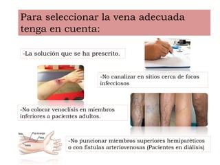-No puncionar miembros superiores hemiparéticos
o con fístulas arteriovenosas (Pacientes en diálisis)
Para seleccionar la vena adecuada
tenga en cuenta:
-La solución que se ha prescrito.
-No canalizar en sitios cerca de focos
infecciosos
-No colocar venoclísis en miembros
inferiores a pacientes adultos.
 