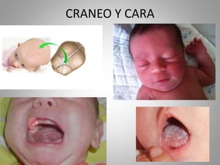 CRANEO Y CARA
 