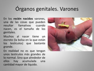 Órganos genitales. Varones
En los recién nacidos varones,
una de las cosas que pueden
resultar llamativas cuando
nacen, es el tamaño de los
genitales.
Muchos al nacer tiene un
escroto (la bolsa en la que están
los testículos) que bastante
grande.
En realidad no es que tengan
unos testículos más grandes de
lo normal. Sino que alrededor de
ellos hay acumulada una
cantidad mayor de líquido.
 