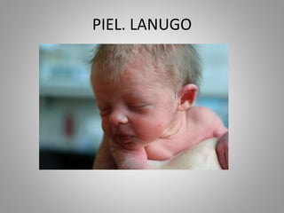 PIEL. LANUGO
 