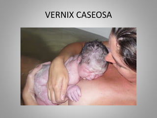 VERNIX CASEOSA
 