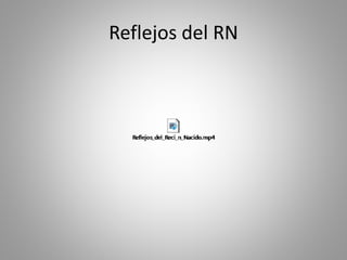 Reflejos del RN
 
