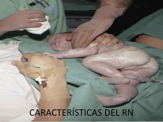 CARACTERÍSTICAS DEL RN
 