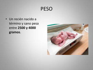 PESO
• Un recién nacido a
término y sano pesa
entre 2500 y 4000
gramos.
 