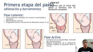 Primera etapa del parto
(dilatación y borramiento)
• ¿Qué es?
Comienza con el inicio del
parto y termina con la
dilatación...