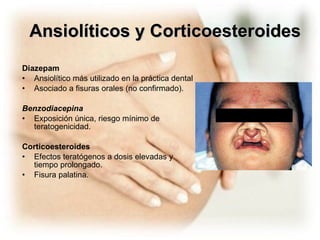 Ansiolíticos y Corticoesteroides Diazepam Ansiolítico más utilizado en la práctica dental Asociado a fisuras orales (no confirmado).  Benzodiacepina   Exposición única, riesgo mínimo de teratogenicidad. Corticoesteroides Efectos teratógenos a dosis elevadas y tiempo prolongado.  Fisura palatina.  
