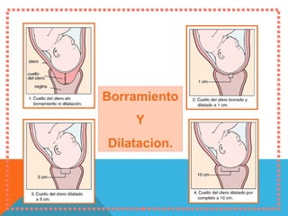 Borramiento  Y Dilatacion. 