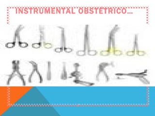 INSTRUMENTAL OBSTÉTRICO… 