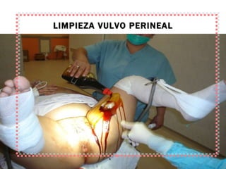 LIMPIEZA VULVO PERINEAL 