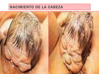 NACIMIENTO DE LA CABEZA 