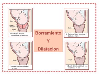 Borramiento  Y Dilatacion 