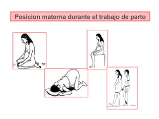 Posicion materna durante el trabajo de parto 