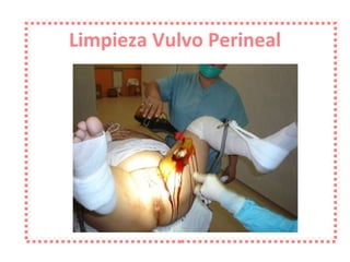 Limpieza Vulvo Perineal 
