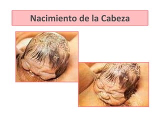 Nacimiento de la Cabeza 