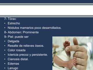 7- Tórax:
• Estrecho
• Nódulos mamarios poco desarrollados.
8- Abdomen: Prominente
9- Piel: puede ser
• Delgada
• Resalte de relieves óseos.
• Color rosada
• Ictericia precoz y persistente.
• Cianosis distal.
• Edemas
• Lanugo
 