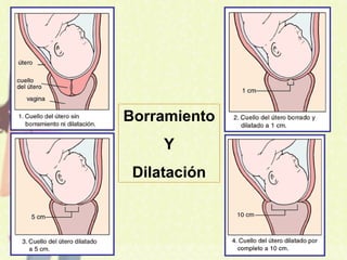 Borramiento
Y
Dilatación
 