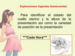 Para identificar el estado del
cuello uterino y la altura de la
presentación así como la variedad
de posición de la presentación
***Cada Hora***
Exploraciones Vaginales Subsecuentes
 