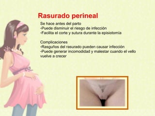 Rasurado perineal
Se hace antes del parto
-Puede disminuir el riesgo de infección
-Facilita el corte y sutura durante la episiotomía
Complicaciones
-Rasguños del rasurado pueden causar infección
-Puede generar incomodidad y malestar cuando el vello
vuelve a crecer
 