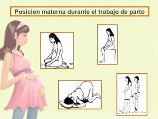 Posicion materna durante el trabajo de parto
 