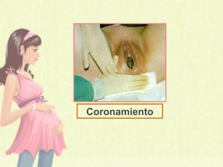Coronamiento
 