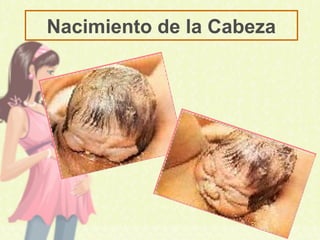 Nacimiento de la Cabeza
 