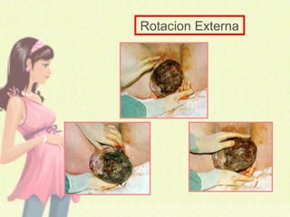 Rotacion Externa
 