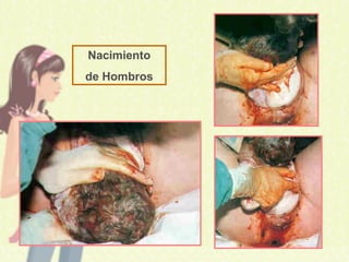 Nacimiento
de Hombros
 