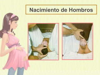 Nacimiento de Hombros
 