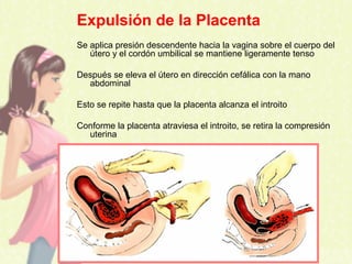 Expulsión de la Placenta
Se aplica presión descendente hacia la vagina sobre el cuerpo del
útero y el cordón umbilical se mantiene ligeramente tenso
Después se eleva el útero en dirección cefálica con la mano
abdominal
Esto se repite hasta que la placenta alcanza el introito
Conforme la placenta atraviesa el introito, se retira la compresión
uterina
 