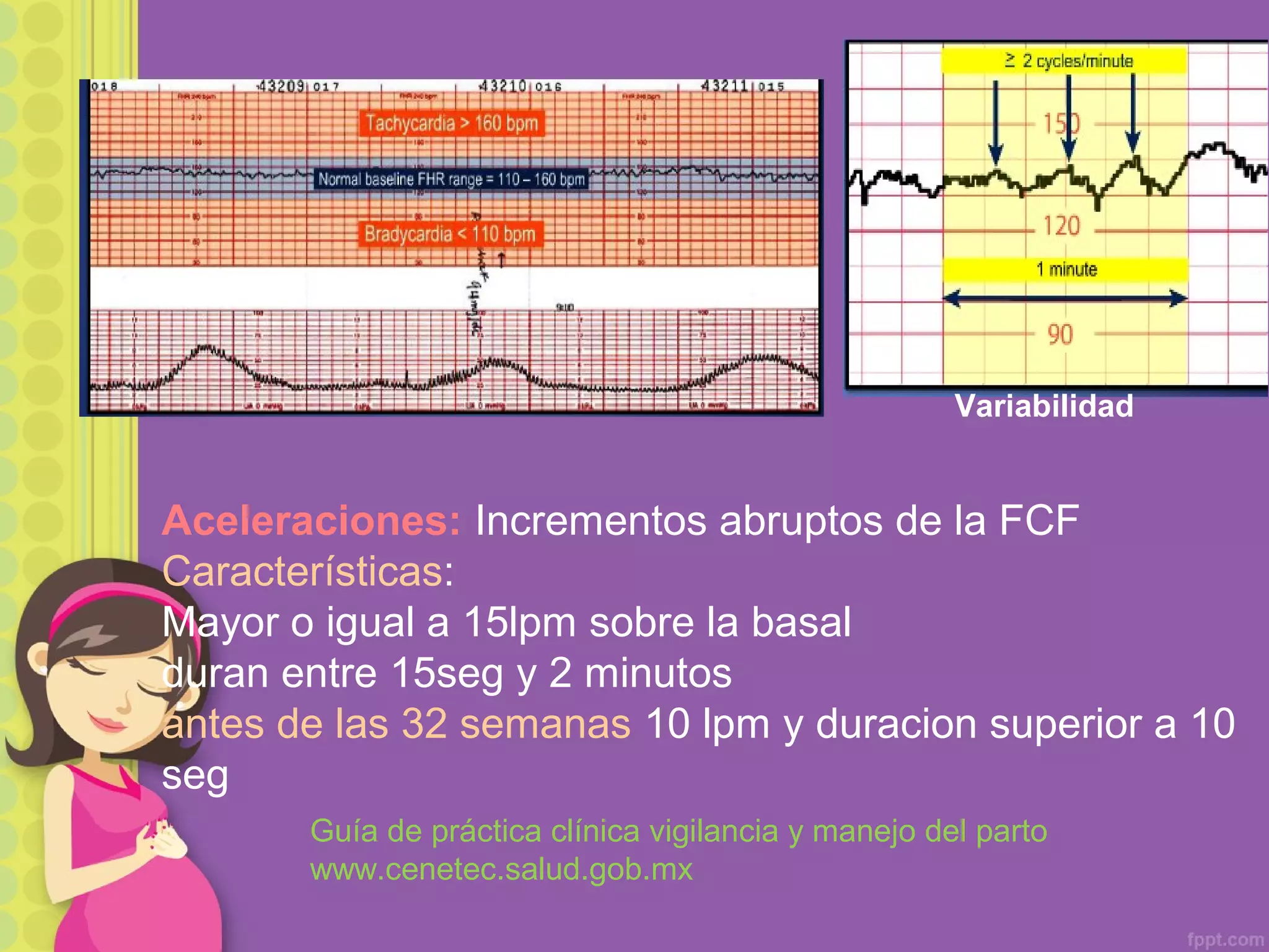 Aceleraciones: Incrementos abruptos de la FCF
Características:
Mayor o igual a 15lpm sobre la basal
duran entre 15seg y 2 minutos
antes de las 32 semanas 10 lpm y duracion superior a 10
seg
Variabilidad
Guía de práctica clínica vigilancia y manejo del parto
www.cenetec.salud.gob.mx
 