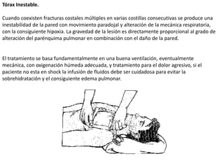 Atencion en urgencias en trauma de torax | PPTX