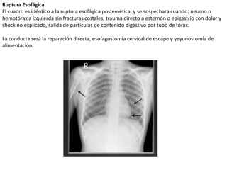 Atencion en urgencias en trauma de torax | PPTX