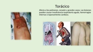 ATENCION INICIAL AL TRAUMA BASE AL ATLSS | PPTX