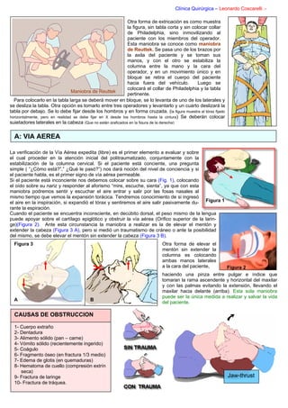 Clínica Quirúrgica – Leonardo Coscarelli .-

                                                              Otra forma de extricación es como muestra
                                                              la figura, sin tabla corta y sin colocar collar
                                                              de Philadelphia, sino inmovilizando al
                                                              paciente con los miembros del operador.
                                                              Esta maniobra se conoce como maniobra
                                                              de Reuttek. Se pasa uno de los brazos por
                                                              la axila del paciente y se toman sus
                                                              manos, y con el otro se estabiliza la
                                                              columna entre la mano y la cara del
                                                              operador, y en un movimiento único y en
                                                              bloque se retira el cuerpo del paciente
                                                              hacia fuera del vehículo.           Luego se
                                                              colocará el collar de Philadelphia y la tabla
                                 Maniobra de Reuttek
                                                              pertinente.
  Para colocarlo en la tabla larga se deberá mover en bloque, se lo levanta de uno de los laterales y
se desliza la tabla. Otra opción es tomarlo entre tres operadores y levantarlo y un cuarto deslizará la
tabla por debajo. Se lo debe fijar desde los hombros y en forma cruzada. (la figura muestra al tórax fijado
horizontalmente, pero en realidad se debe fijar en X desde los hombros hasta la cintura) Se deberán colocar
sujetadores laterales en la cabeza (Que no están graficados en la figura de la derecha)


  A: VIA AEREA

La verificación de la Vía Aérea expedita (libre) es el primer elemento a evaluar y sobre
el cual proceder en la atención inicial del politraumatizado, conjuntamente con la
estabilización de la columna cervical. Si el paciente está conciente, una pregunta
simple ( “¿Cómo está?”,” ¿Qué le pasó?”) nos dará noción del nivel de conciencia y si
el paciente habla, es el primer signo de vía aérea permeable.
Si el paciente está inconciente nos debemos colocar sobre su cara (Fig. 1), colocando
el oído sobre su nariz y responder al aforismo “mire, escuche, sienta”, ya que con esta
maniobra podremos sentir y escuchar el aire entrar y salir por las fosas nasales al
mismo tiempo que vemos la expansión torácica. Tendremos conocimiento de si ingresó
el aire en la inspiración, si expandió el tórax y sentiremos el aire salir pasivamente du- Figura 1
rante la espiración.
Cuando el paciente se encuentra inconsciente, en decúbito dorsal, el peso mismo de la lengua
puede apoyar sobre el cartílago epiglótico y obstruir la vía aérea (Orifico superior de la larin-
ge)(Figura 2). Ante esta circunstancia la maniobra a realizar es la de elevar el mentón y
extender la cabeza (Figura 3 A), pero si medió un traumatismo de cráneo o ante la posibilidad
del mismo, se debe elevar el mentón sin extender la cabeza (Figura 3 B).
  Figura 3                                                                   Otra forma de elevar el
                                                                             mentón sin extender la
                                                                             columna es colocando
                                                                             ambas manos laterales
                                                                             a la cara del paciente,      Figura 2
                                                                             haciendo una pinza entre pulgar e índice que
                                                                             tomaran la rama ascendente y horizontal del maxilar
                                                                             y con las palmas evitando la extensión, llevando el
                                                                             maxilar hacia delante (arriba). Esta sola maniobra
                                                                             puede ser la única medida a realizar y salvar la vida
  A                                     B
                                                                             del paciente.

  CAUSAS DE OBSTRUCCION

  1- Cuerpo extraño
  2- Dentadura
  3- Alimento sólido (pan – carne)
  4- Vómito sólido (recientemente ingerido)
  5- Coágulo
  6- Fragmento óseo (en fractura 1/3 medio)
  7- Edema de glotis (en quemaduras)
  8- Hematoma de cuello (compresión extrín
     seca)
  9- Fractura de laringe                                                                                        Jaw-thrust
  10- Fractura de tráquea.
 