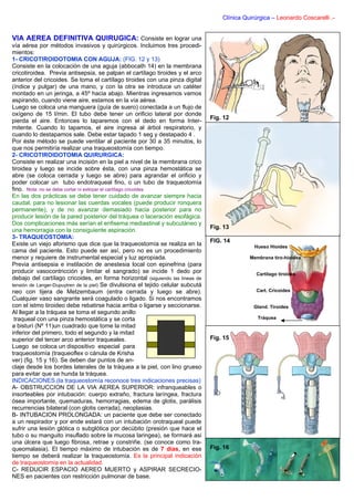 Clínica Quirúrgica – Leonardo Coscarelli .-


VIA AEREA DEFINITIVA QUIRUGICA: Consiste en lograr una
vía aérea por métodos invasivos y quirúrgicos. Incluimos tres procedi-
mientos:
1- CRICOTIROIDOTOMIA CON AGUJA: (FIG. 12 y 13)
Consiste en la colocación de una aguja (abbocath 14) en la membrana
cricotiroidea. Previa antisepsia, se palpan el cartílago tiroides y el arco
anterior del cricoides. Se toma el cartílago tiroides con una pinza digital
(índice y pulgar) de una mano, y con la otra se introduce un catéter
montado en un jeringa, a 45º hacia abajo. Mientras ingresamos vamos
aspirando, cuando viene aire, estamos en la vía aérea.
Luego se coloca una manguera (guía de suero) conectada a un flujo de
oxígeno de 15 l/min. El tubo debe tener un orificio lateral por donde
                                                                                  Fig. 12
pierda el aire. Entonces lo taparemos con el dedo en forma Inter-
mitente. Cuando lo tapamos, el aire ingresa al árbol respiratorio, y
cuando lo destapamos sale. Debe estar tapado 1 seg y destapado 4 .
Por éste método se puede ventilar al paciente por 30 a 35 minutos, lo
que nos permitiría realizar una traqueostomía con tiempo.
2- CRICOTIROIDOTOMIA QUIRURGICA:
Consiste en realizar una incisión en la piel a nivel de la membrana crico
tiroidea y luego se incide sobre ésta, con una pinza hemostática se
abre (se coloca cerrada y luego se abre) para agrandar el orificio y
poder colocar un tubo endotraqueal fino, o un tubo de traqueotomía
fino. Nota: no se debe cortar ni extirpar el cartílago cricoides.
En las dos prácticas se debe tener cuidado de avanzar siempre hacia
caudal, para no lesionar las cuerdas vocales (puede producir ronquera
permanente), y de no avanzar demasiado hacia posterior para no
producir lesión de la pared posterior del tráquea o laceración esofágica.
Dos complicaciones más serían el enfisema mediastinal y subcutáneo y
                                                                                  Fig. 13
una hemorragia con la consiguiente aspiración.
3- TRAQUEOSTOMIA:
                                                                                  FIG. 14
Existe un viejo aforismo que dice que la traqueostomía se realiza en la                           Hueso Hioides
cama del paciente. Esto puede ser así, pero no es un procedimiento
menor y requiere de instrumental especial y luz apropiada.                                      Membrana tiro-hioidea
Previa antisepsia e instilación de anestesia local con epinefrina (para
producir vasocontricción y limitar el sangrado) se incide 1 dedo por                              Cartílago tiroides
debajo del cartílago cricoides, en forma horizontal (siguiendo las líneas de
tensión de Langer-Dupuytren de la piel) Se divulsiona el tejido celular subcutá
neo con tijera de Metzembaum (entra cerrada y luego se abre).                                     Cart. Cricoides
Cualquier vaso sangrante será coagulado o ligado. Si nos encontramos
con el istmo tiroideo debe rebatirse hacia arriba o ligarse y seccionarse.                       Gland. Tiroides
Al llegar a la tráquea se toma el segundo anillo
 traqueal con una pinza hemostática y se corta                                                     Tráquea
a bisturí (Nº 11)un cuadrado que tome la mitad
inferior del primero, todo el segundo y la mitad
superior del tercer arco anterior traqueales.                                     Fig. 15
Luego se coloca un dispositivo especial para
traqueostomía (traqueoflex o cánula de Krisha
ver) (fig. 15 y 16). Se deben dar puntos de an-
claje desde los bordes laterales de la tráquea a la piel, con lino grueso
para evitar que se hunda la tráquea.
INDICACIONES.(la traqueostomía reconoce tres indicaciones precisas)
A- OBSTRUCCION DE LA VIA AEREA SUPERIOR: infranqueables o
insorteables por intubación: cuerpo extraño, fractura laríngea, fractura
ósea importante, quemaduras, hemorragias, edema de glotis, parálisis
recurrencias bilateral (con glotis cerrada), neoplasias.
B- INTUBACION PROLONGADA: un paciente que debe ser conectado
a un respirador y por ende estará con un intubación orotraqueal puede
sufrir una lesión glótica o subglótica por decúbito (presión que hace el
tubo o su manguito insuflado sobre la mucosa laringea), se formará asi
una úlcera que luego fibrosa, retrae y constriñe. (se conoce como tra-
queomalasia). El tiempo máximo de intubación es de 7 días, en ese                 Fig. 16
tiempo se deberá realizar la traqueostomía. Es la principal indicación
de traqueostomía en la actualidad.
C- REDUCIR ESPACIO AEREO MUERTO y ASPIRAR SECRECIO-
NES en pacientes con restricción pulmonar de base.
 