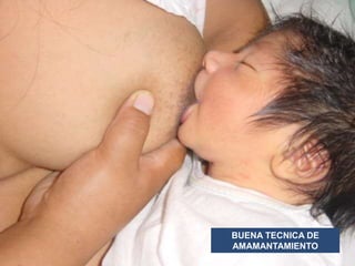 Dr. Raúl Urquizo A 
BUENA TECNICA DE 
AMAMANTAMIENTO 
 