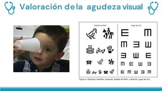 Valoración dela agudeza visual
 