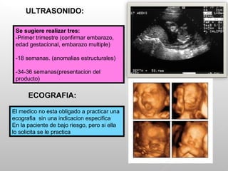 Se sugiere realizar tres:
-Primer trimestre (confirmar embarazo,
edad gestacional, embarazo multiple)
-18 semanas. (anomalias estructurales)
-34-36 semanas(presentacion del
producto)
ULTRASONIDO:
ECOGRAFIA:
El medico no esta obligado a practicar una
ecografia sin una indicacion especifica
En la paciente de bajo riesgo, pero si ella
lo solicita se le practica
 