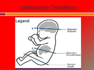 Ultrasonido Obstétrico
 