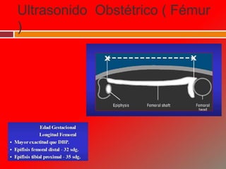 Ultrasonido Obstétrico ( Fémur
)
 