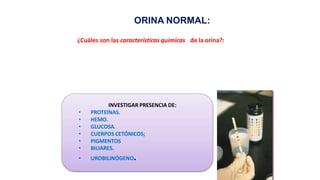 ORINA NORMAL:
INVESTIGAR PRESENCIA DE:
• PROTEÍNAS.
• HEMO.
• GLUCOSA.
• CUERPOS CETÓNICOS;
• PIGMENTOS
• BILIARES.
• UROBILINÓGENO.
¿Cuáles son las características químicas de la orina?:
 