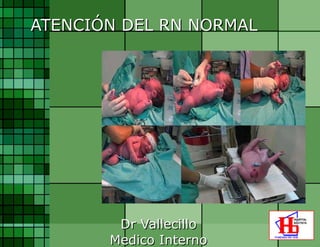 ATENCIÓN DEL RN NORMAL Dr Vallecillo Medico Interno 