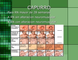 CAPURRO Para RN mayor de 28 semanas A RN sin alteracion neuromuscular B RN con alteracion neuromuscular 