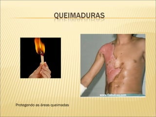 Protegendo as áreas queimadas 